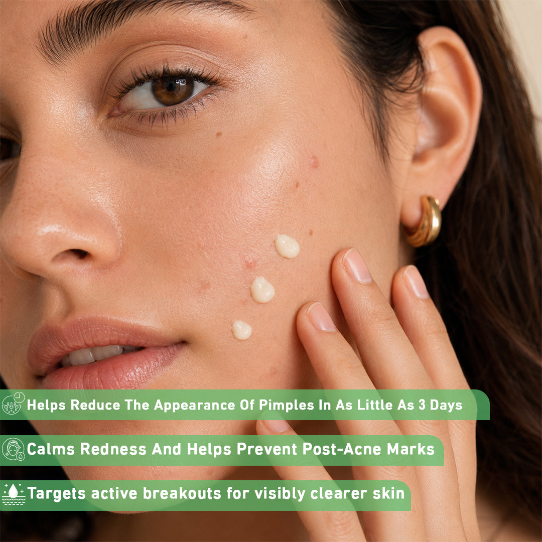 Sebuclear Cream-كريم للبشرة المعرضة للحبوب