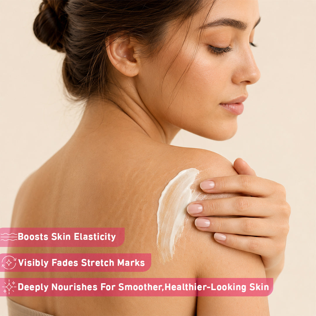 Stretch Mark Cream-كريم علامات التمدد